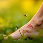 Яка комаха кусає за ногу: види, симптоми і перша допомога