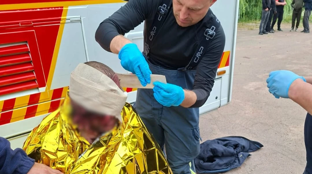 Медики надають першу допомогу постраждалому внаслідок російської атаки на агропідприємство у Житомирській області 30 липня
